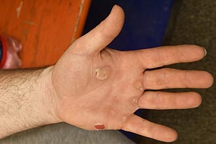 2023 11 08 hand links