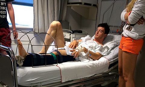 Herlings femur 2107