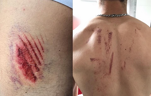 Gajser back after crash Kegums 2017